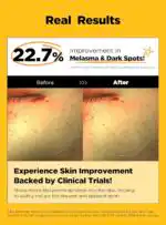 Buy BeWants Glutathione Dark Spot Patch | Clear Acne Marks - Image 7